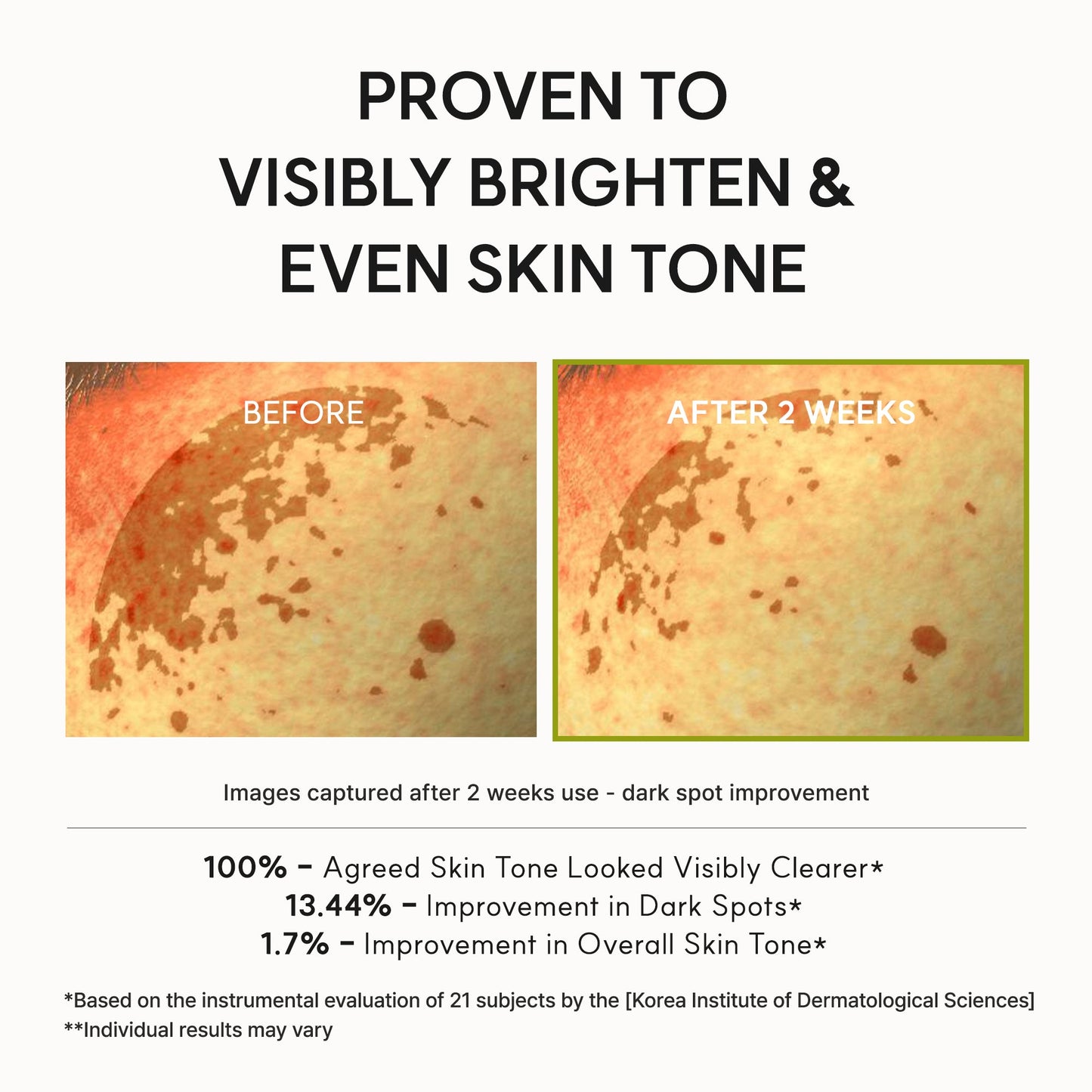 [Amazon] Vitamin C Booster Shot, Pure Vitamin C + Glutathione for Bright, Healthy Skin Glow, 1.01 fl oz