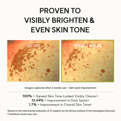 [Amazon] Vitamin C Booster Shot, Pure Vitamin C + Glutathione for Bright, Healthy Skin Glow, 1.01 fl oz