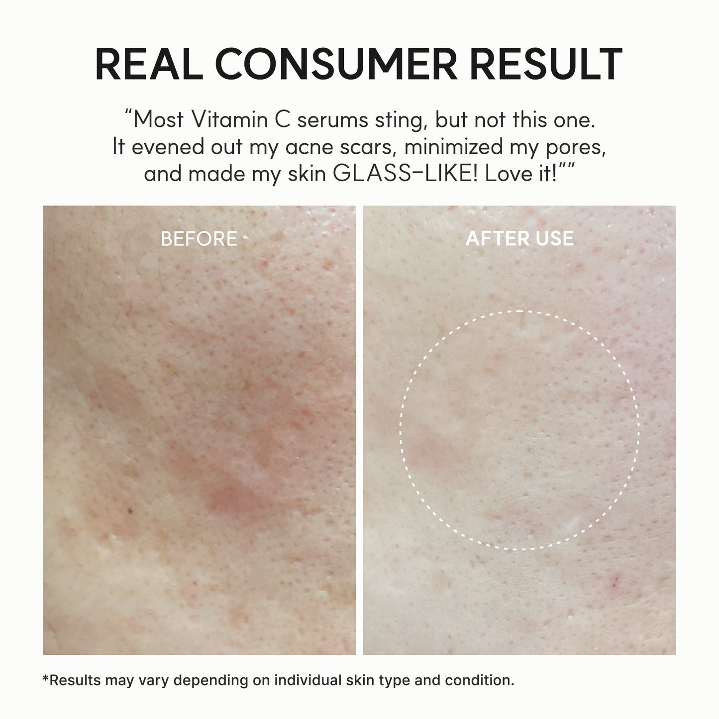 [Amazon] Vitamin C Booster Shot, Pure Vitamin C + Glutathione for Bright, Healthy Skin Glow, 1.01 fl oz
