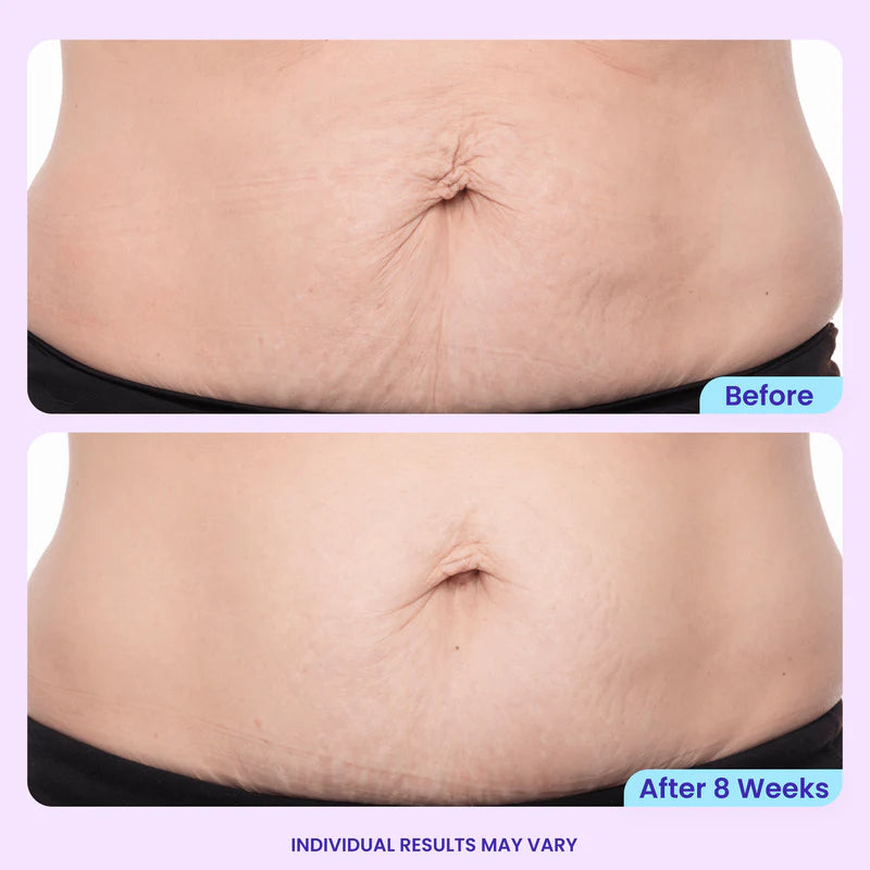 Tighten & Smooth Belly Cream
