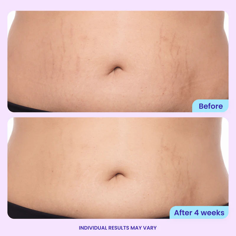 Tighten & Smooth Belly Cream