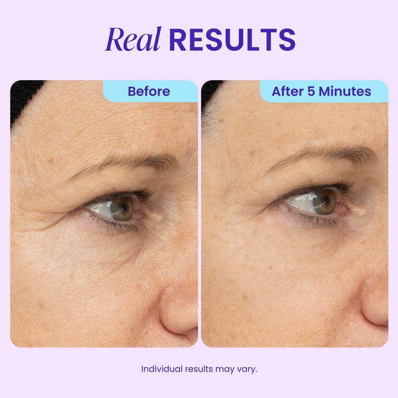 NEW! Instant Lift Eye Gel